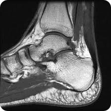 Stanford MSK MRI Atlas (c) 2022 Stanford MSK MRI Atlas (c) 2022