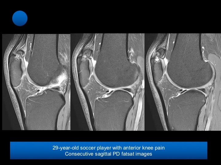 Figure 3 for case patella