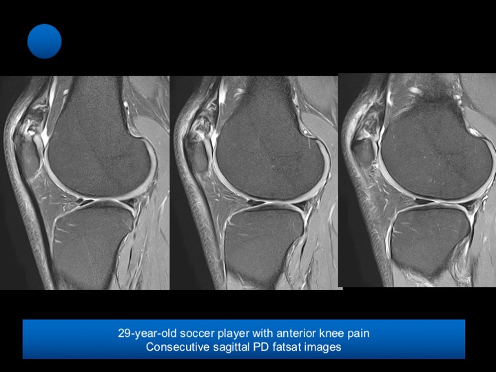 Figure 4 for case patella