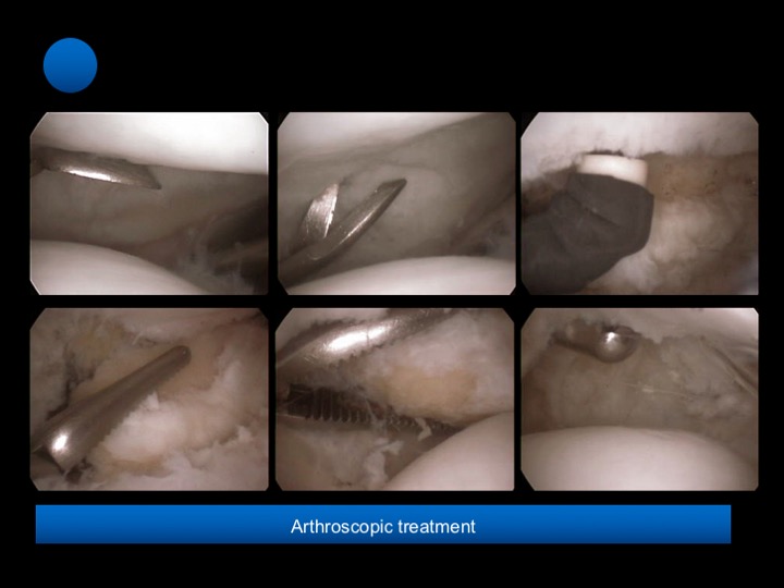 Figure 5 for case patella