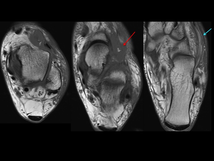 Figure 2 for case bursa
