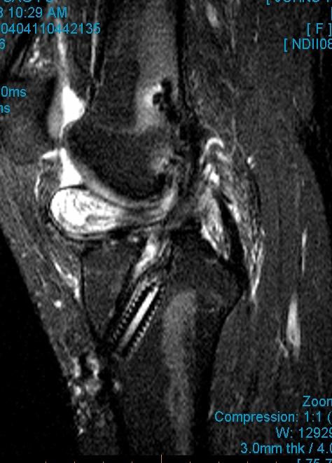 Figure 2 for case Cyclops