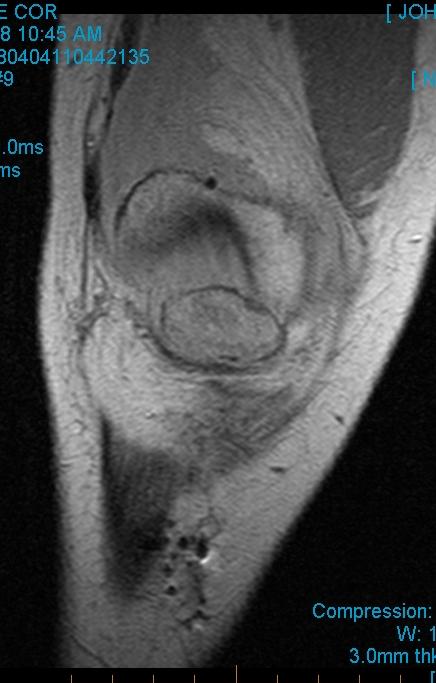 Figure 3 for case Cyclops