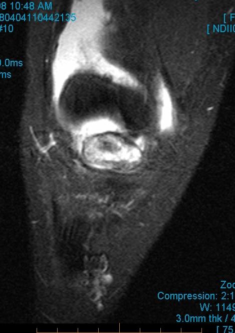 Figure 4 for case Cyclops