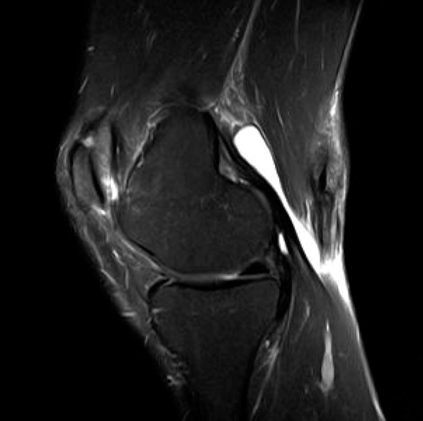 Figure 4 for case Hematoma