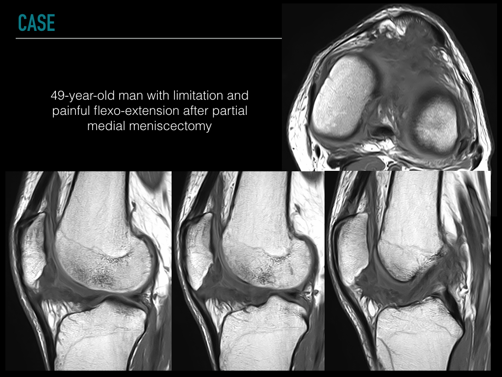 Figure 1 for case art