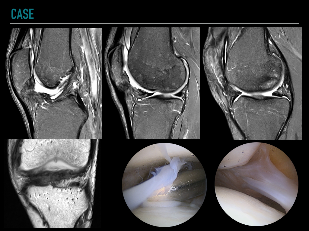 Figure 2 for case art