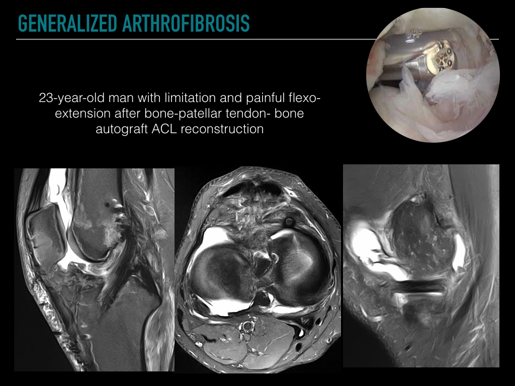 Figure 3 for case art