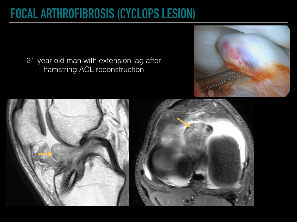 Figure 4 for case art