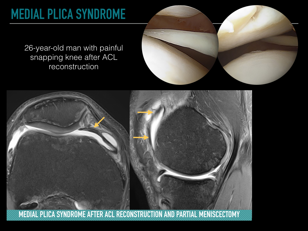Figure 5 for case art